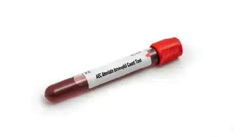 What Level of Eosinophils Indicates Cancer?